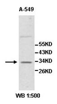 ZNF146 Rabbit Polyclonal Antibody