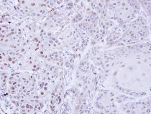 ZNF165 Rabbit Polyclonal Antibody