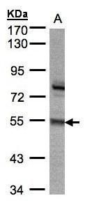 ZNF165 Rabbit Polyclonal Antibody
