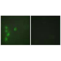 ZNF174 Antibody