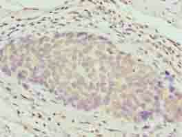 ZNF177 antibody