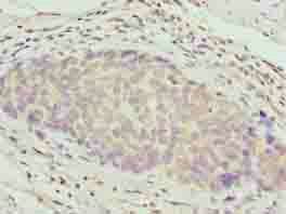 ZNF177 Antibody