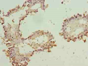 ZNF184 Antibody