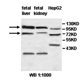 ZNF184 Rabbit Polyclonal Antibody