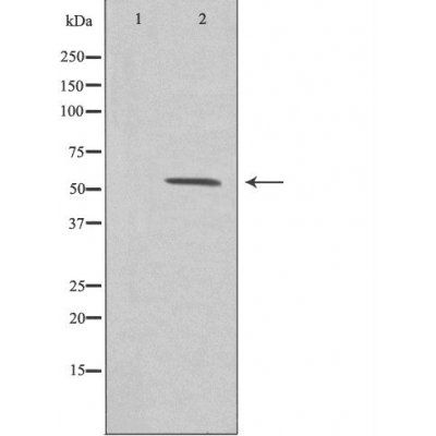 ZNF187 antibody