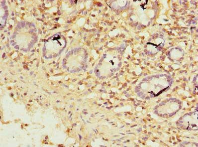 ZNF19 antibody