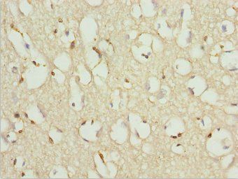 ZNF195 Antibody