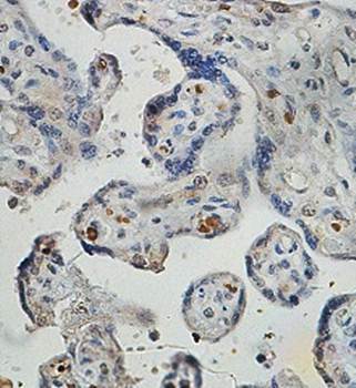 ZNF195 Rabbit Polyclonal Antibody