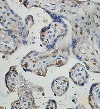 ZNF195 antibody