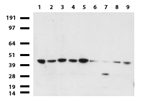 ZNF2 Antibody