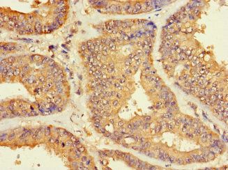 ZNF2 Antibody