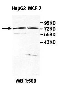 ZNF202 Rabbit Polyclonal Antibody