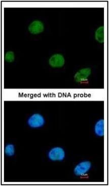 ZNF211 antibody [N3C2], Internal