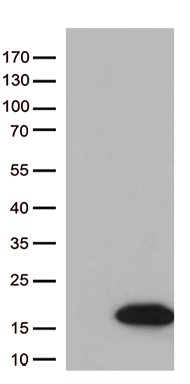 ZNF213 Antibody