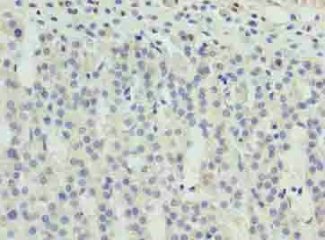 ZNF215 antibody