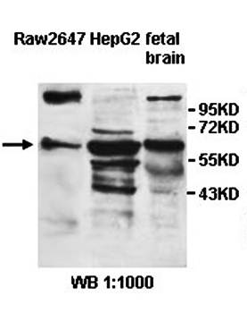 ZNF215 Rabbit Polyclonal Antibody