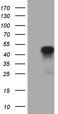 ZNF217 antibody