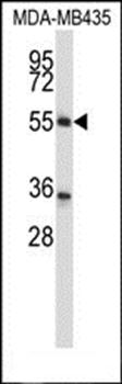 ZNF222 antibody