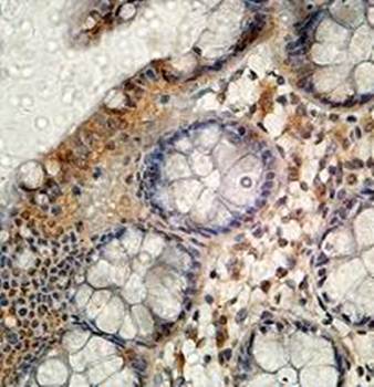 ZNF223 Rabbit Polyclonal Antibody