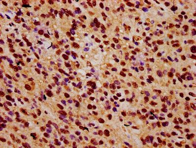ZNF224 Antibody