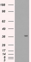 ZNF226 antibody