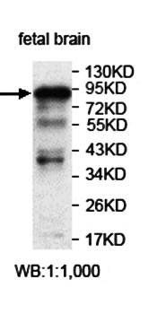 ZNF227 Rabbit Polyclonal Antibody