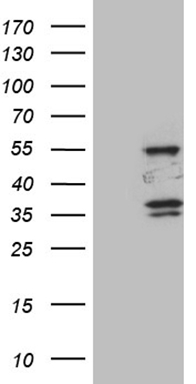 ZNF230 antibody
