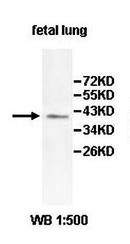 ZNF248 Rabbit Polyclonal Antibody