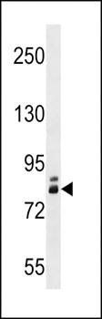 ZNF252 antibody