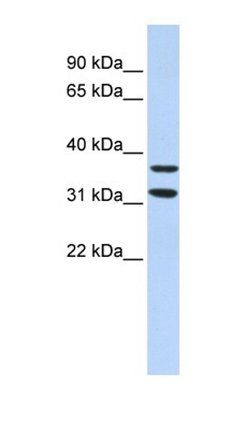 ZNF254 antibody