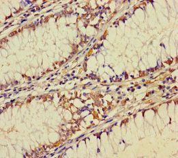 ZNF260 antibody