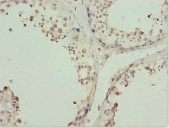 ZNF264 Antibody