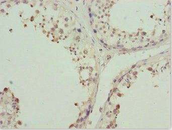 ZNF264 antibody