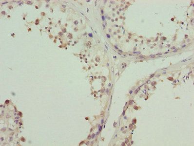 ZNF264 Antibody