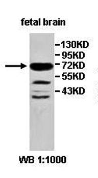 ZNF264 Rabbit Polyclonal Antibody
