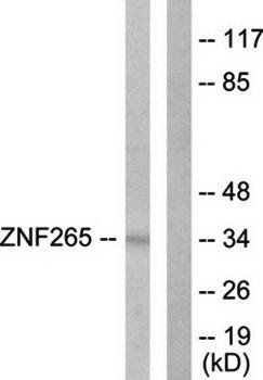 ZNF265 antibody