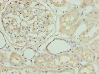 ZNF274 antibody