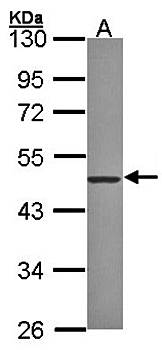 ZNF277 antibody