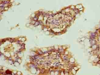ZNF281 Antibody