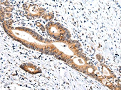 ZNF281 antibody