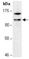 ZNF281 (C) Antibody, Rabbit Polyclonal