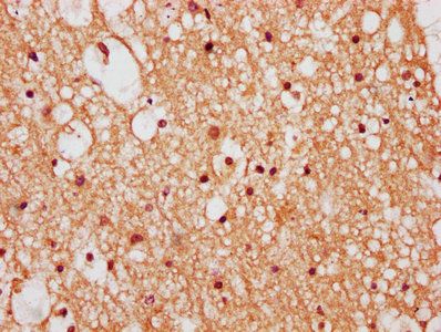 ZNF282 Antibody