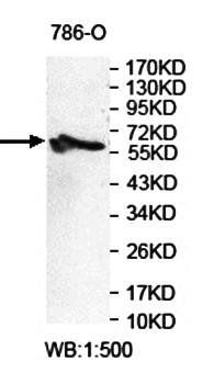 ZNF285 Rabbit Polyclonal Antibody