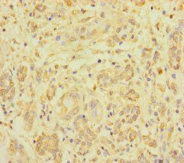 ZNF287 Antibody