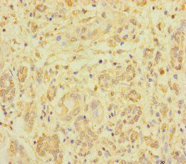 ZNF287 antibody