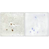 ZNF287 antibody