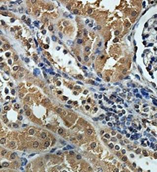 ZNF287 Rabbit Polyclonal Antibody
