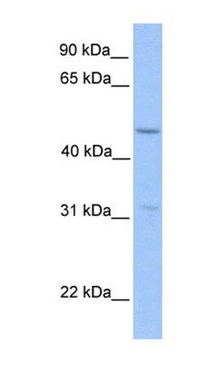 ZNF296 antibody