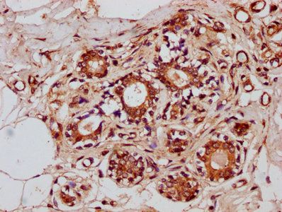 ZNF3 Antibody