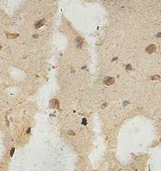 ZNF300 Rabbit Polyclonal Antibody